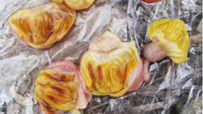雞腺肌胃炎